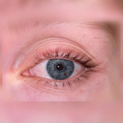 Vippeserum Duo Pack