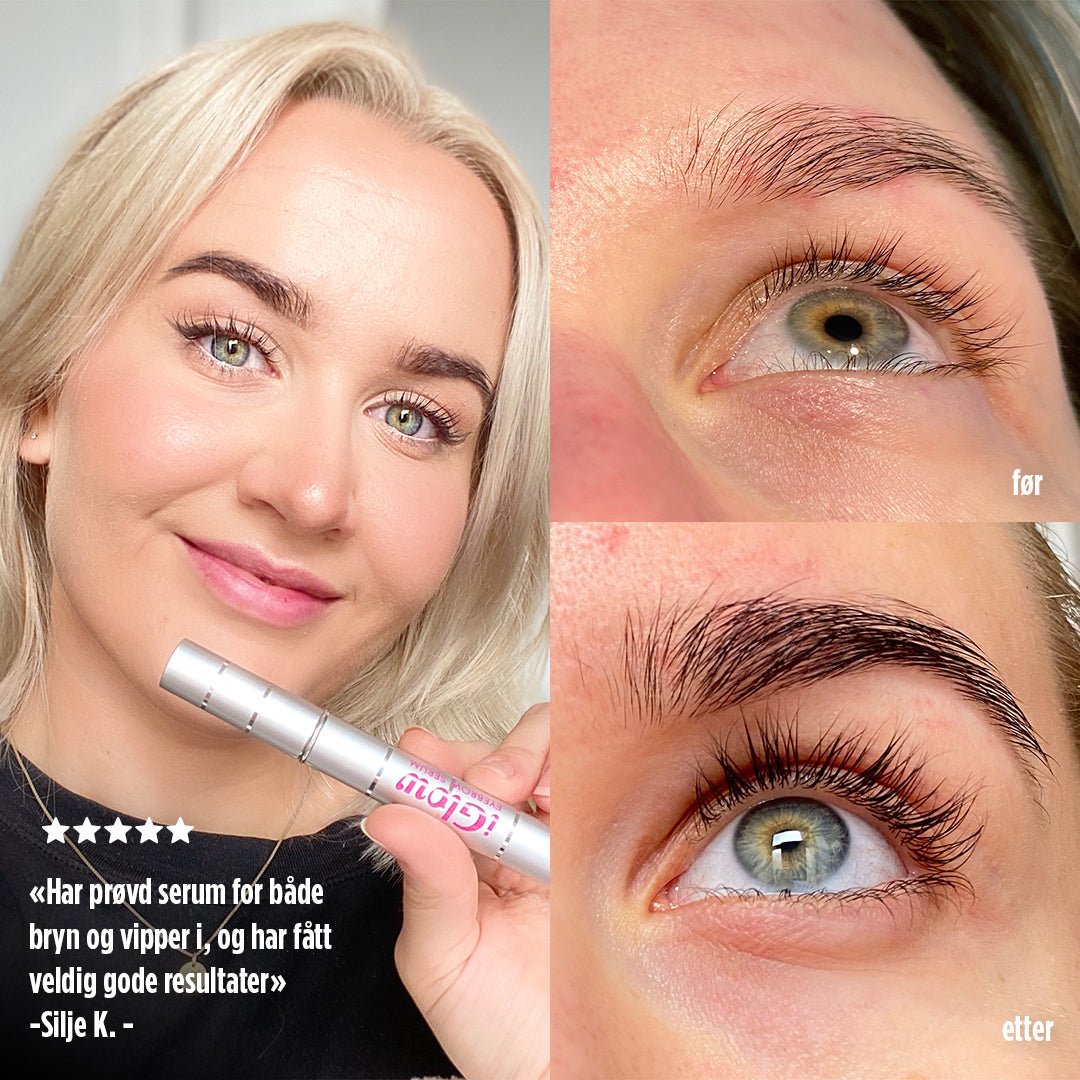 iGlow Essentials Kit 1 - iGlow.no