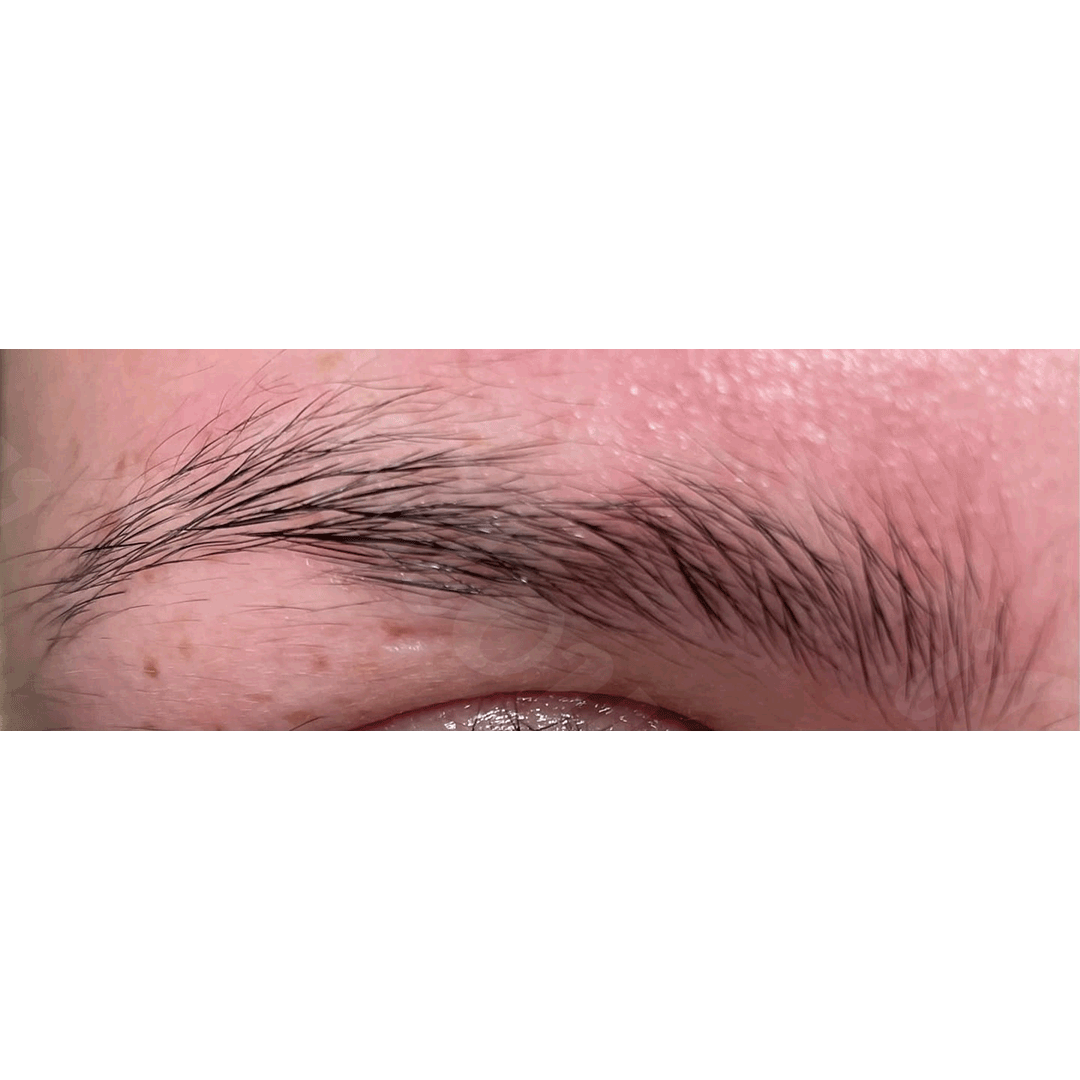 Brynserum Trio Pack